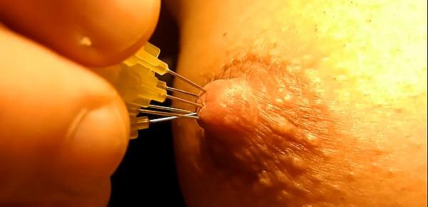  little needles pulling out from nipple